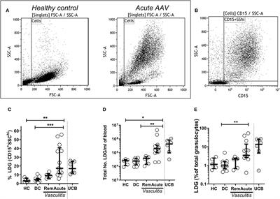 Low Density Granulocytes in ANCA Vasculitis Are Heterogenous and Hypo-Responsive to Anti-Myeloperoxidase Antibodies